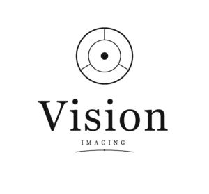 Vision